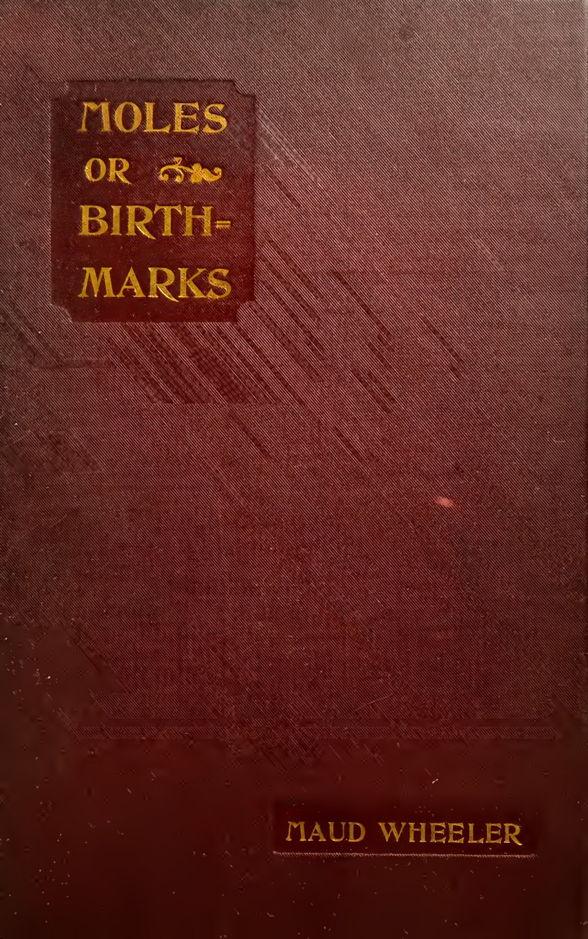 Cover of Moles, or Birth-Marks, and Their Signification